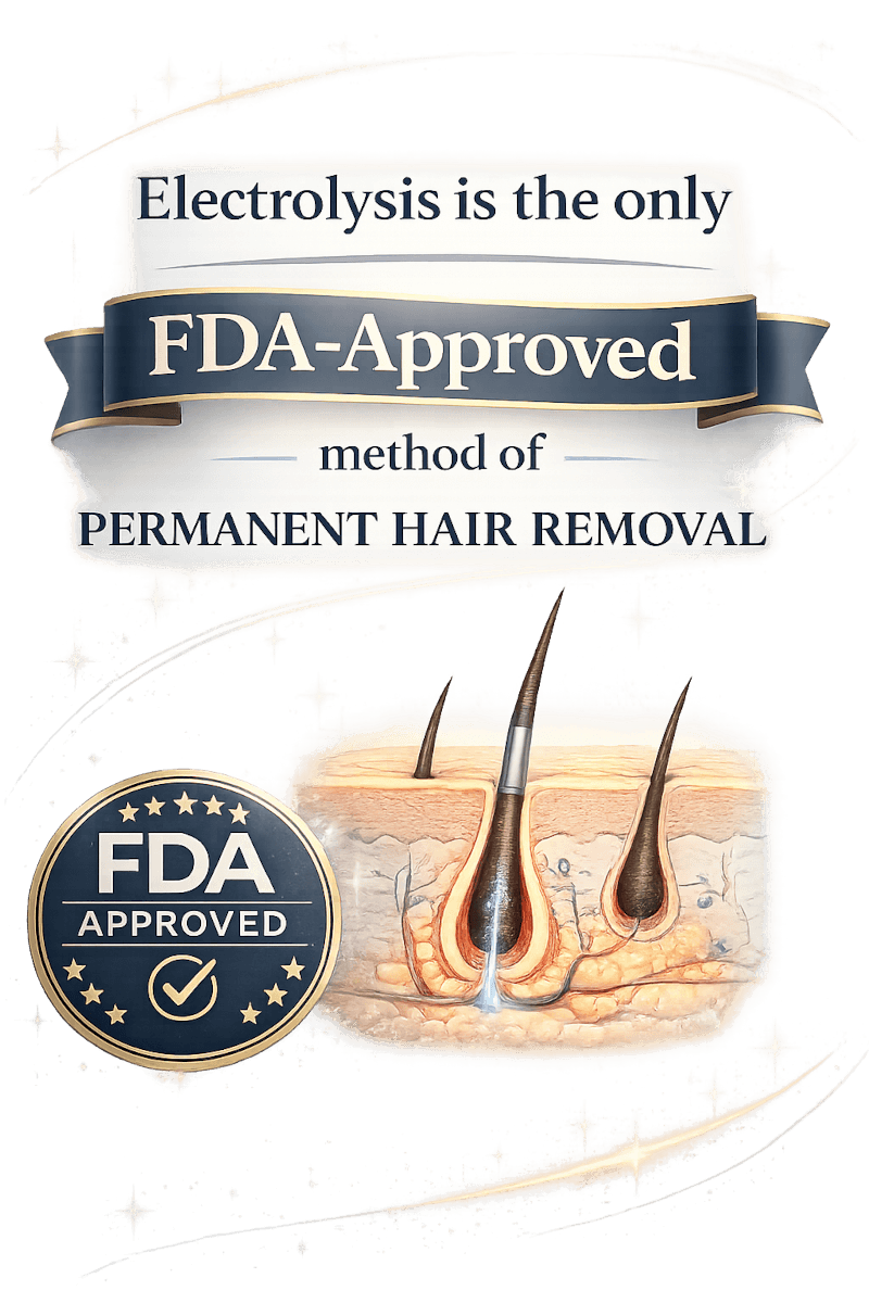 Illustration demonstrating electrolysis as the only FDA-approved permanent hair removal method with hair follicle diagram.